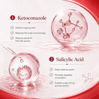 KORMESIC 2% Ketoconazole Shampoo for Women, Salicylic Acid Anti Dandruff Shampoo, Itchy Flaky Scalp Treatment, Oil Control, Soothes Irritated Scalp with Centella Asiatica Extract — product image 3